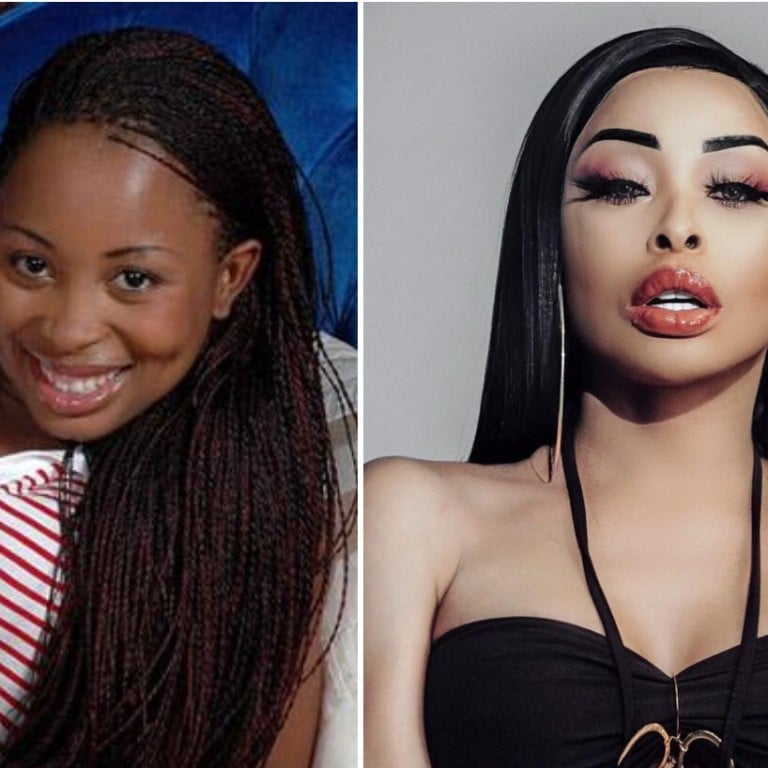 Khanyi Mbau's dramatic body transformation: Netflix's Young, Famous and African star believes it's her duty to 'look like a doll' and even invited media to watch her liposuction | South China Morning