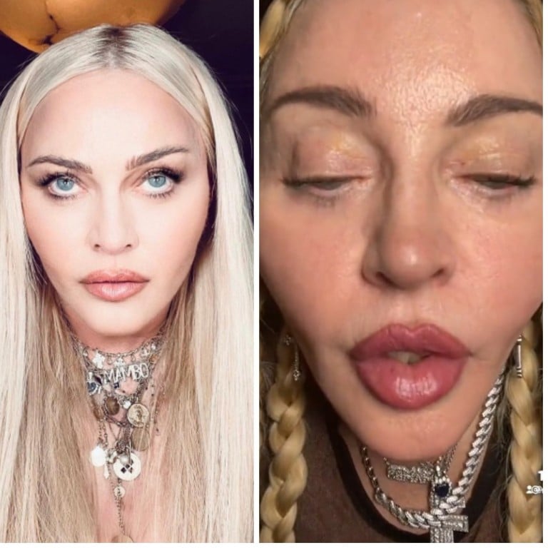 Madonna’s face has everyone talking on social media. Photos: @madonna/Instagram, @madonna/TikTok