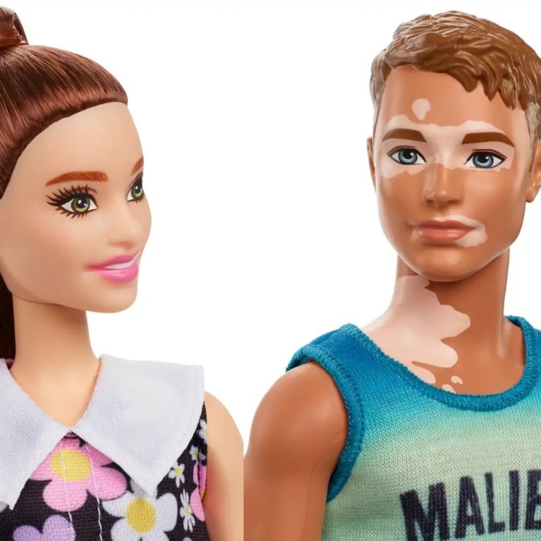 Barbie and Ken reflect body diversity with hearing aids colourful