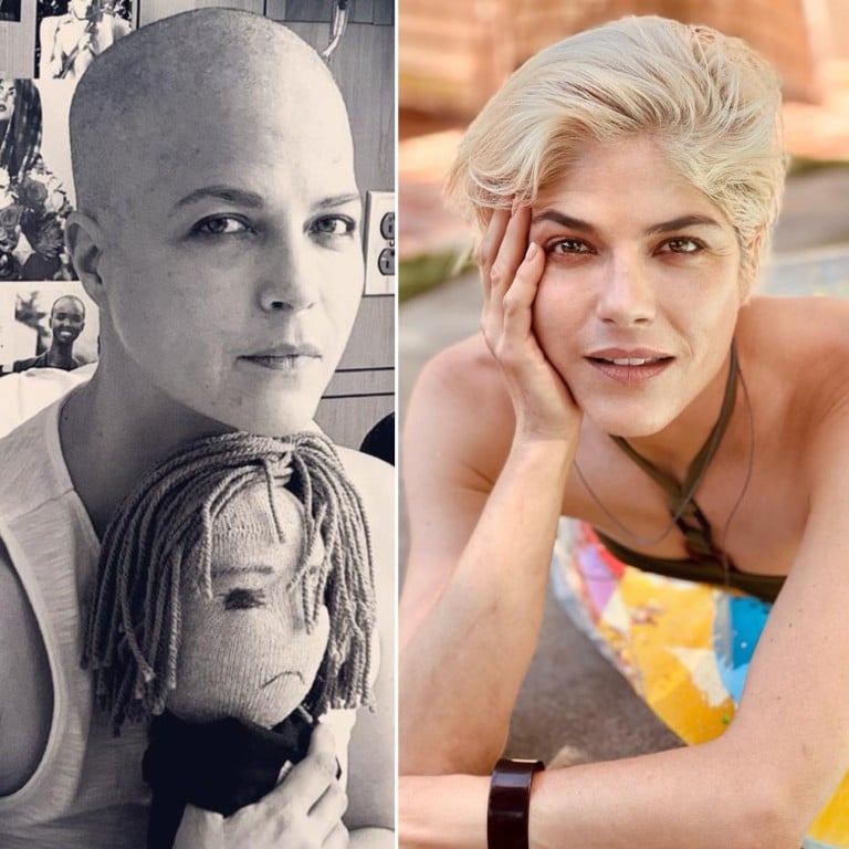 Selma Blair has served as an inspiration for battling multiple sclerosis. Photos: @selmablair/Instagram