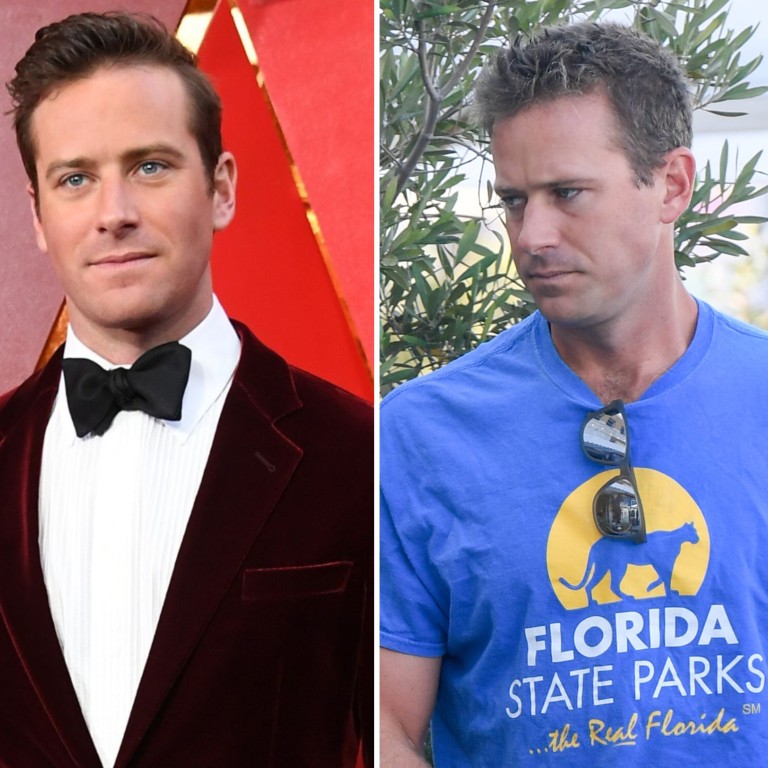 American actor Armie Hammer faced some serious abuse allegations in 2021. Photos: AFP, Getty Images