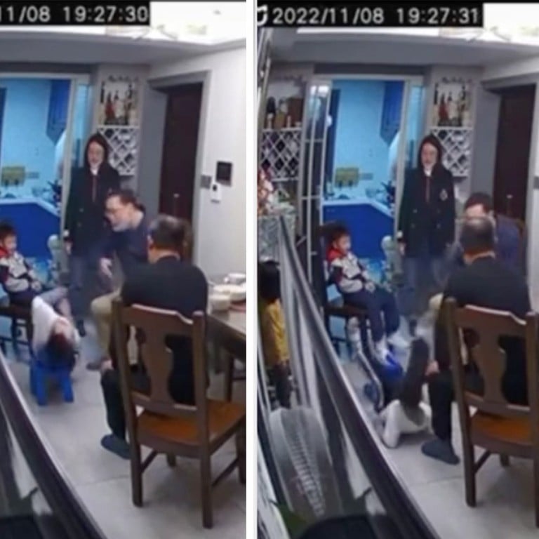 Swollen, bruised face for boy, 5, after alleged slap from Chinese ...