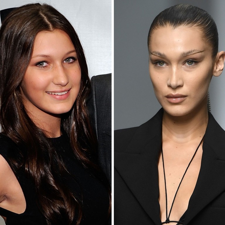 6 ways to get a slimmer face: apart from buccal fat removal, which Bella  Hadid is rumoured to have done, experts also suggest Botox, neck lipo,  fillers and facelifts – or straight-up