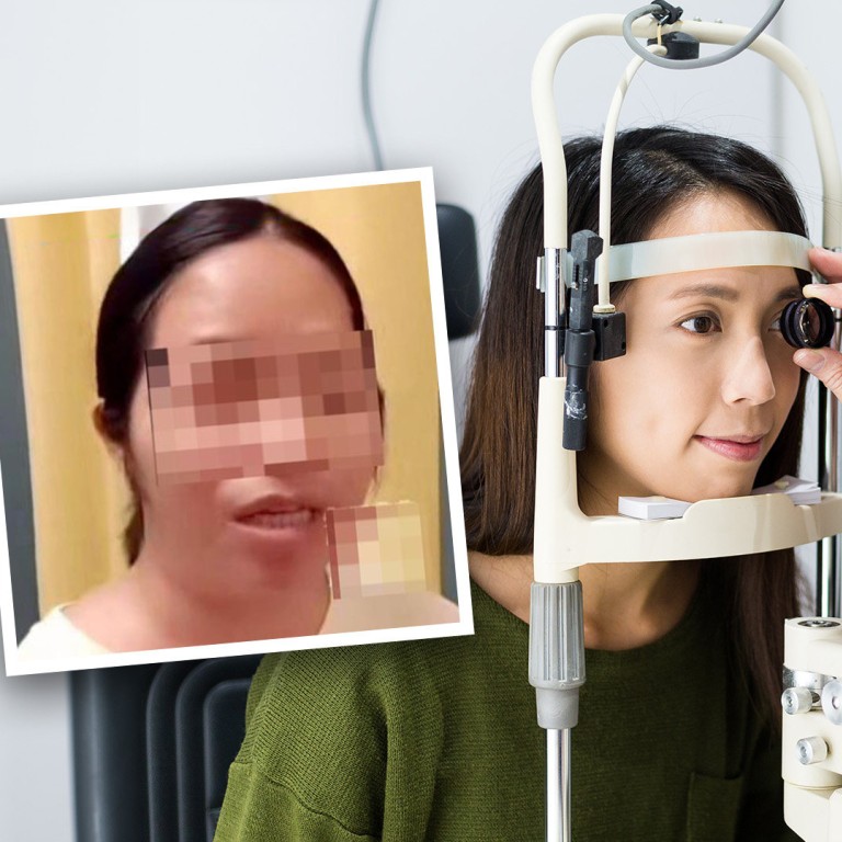 ‘You still have one eye’: fury as partially blind Chinese woman told ...