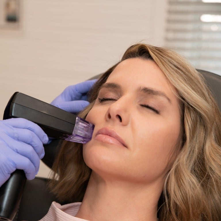 Morpheus8 is a skin treatment device that’s been getting much attention. Photo: Handout