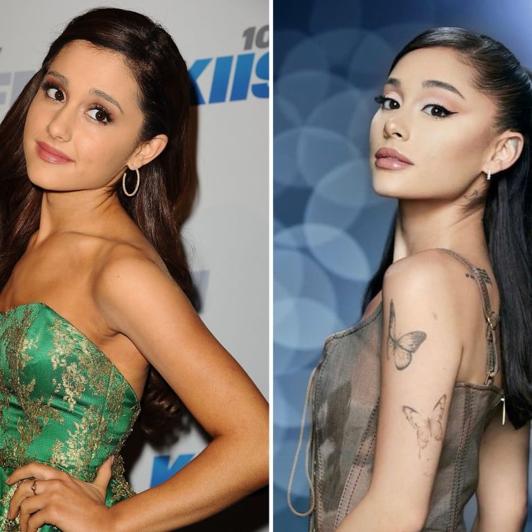Pop princess Ariana Grande revealed that she got lip fillers and Botox in the past. Photos: Getty Images, @arianagrande/Instagram