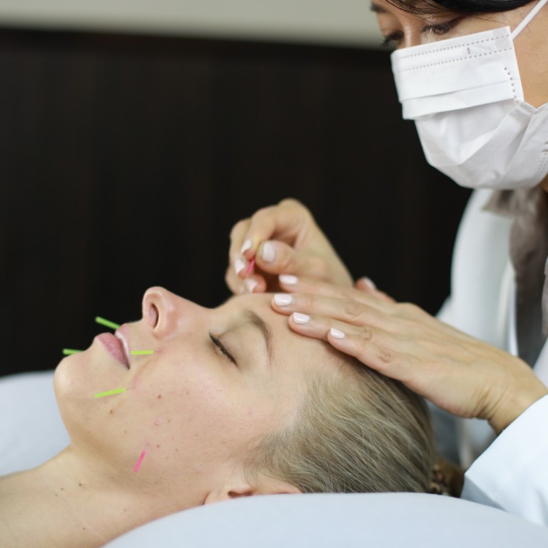 How facial acupuncture is a natural alternative to Botox how