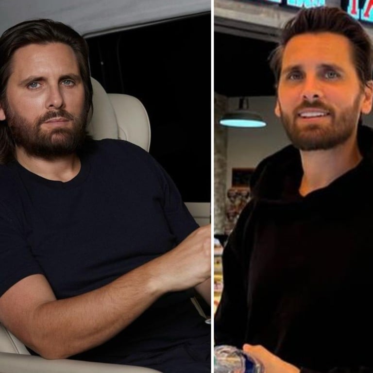 Reality TV star Scott Disick’s post-Ozempic transformation resulted in a gaunt-looking face – and he’s not the only one who has it. Photos: @letthelordbewithyou/Instagram