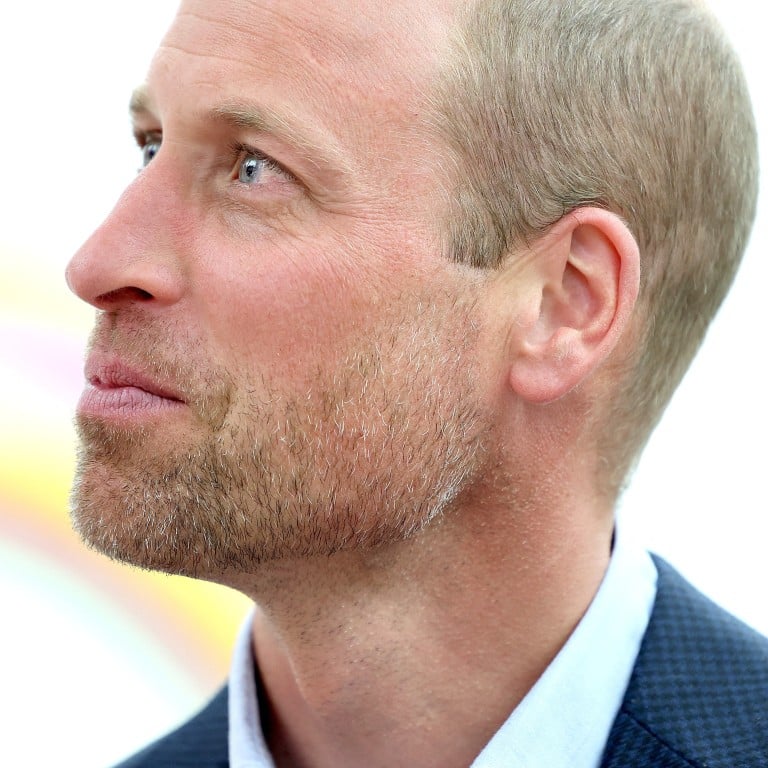 Prince William, Prince of Wales, rocking his royal stubble at the “Homelessness: Reframed” exhibition in London. Photo: Reuters