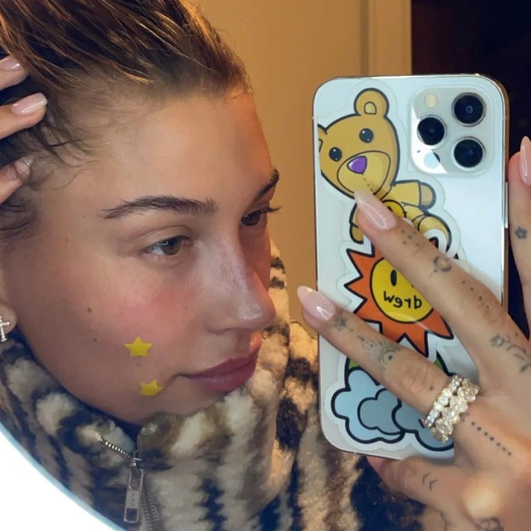 Starface and other pimple patch brands are attracting even A-listers like Hailey Bieber and Florence Pugh to try their simple spot fix. Photo: @haileybieber/Instagram