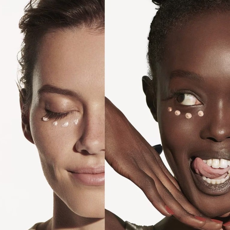 Under-eye bags or dark circles? Work out which is affecting you and you’ll be better able to fix the problem. Photo: Handout