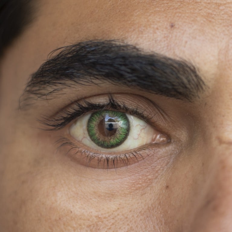 Eye-colour surgery may be trending on TikTok – but the risk of something going wrong during the procedure are high. Photo: Getty Images