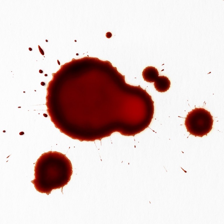 Why the science behind Kim Kardashian’s “vampire facial” remains popular – from platelet-rich plasma therapy to extracting stem cells after liposuction to be used in regenerative treatments. Photo: Getty Images