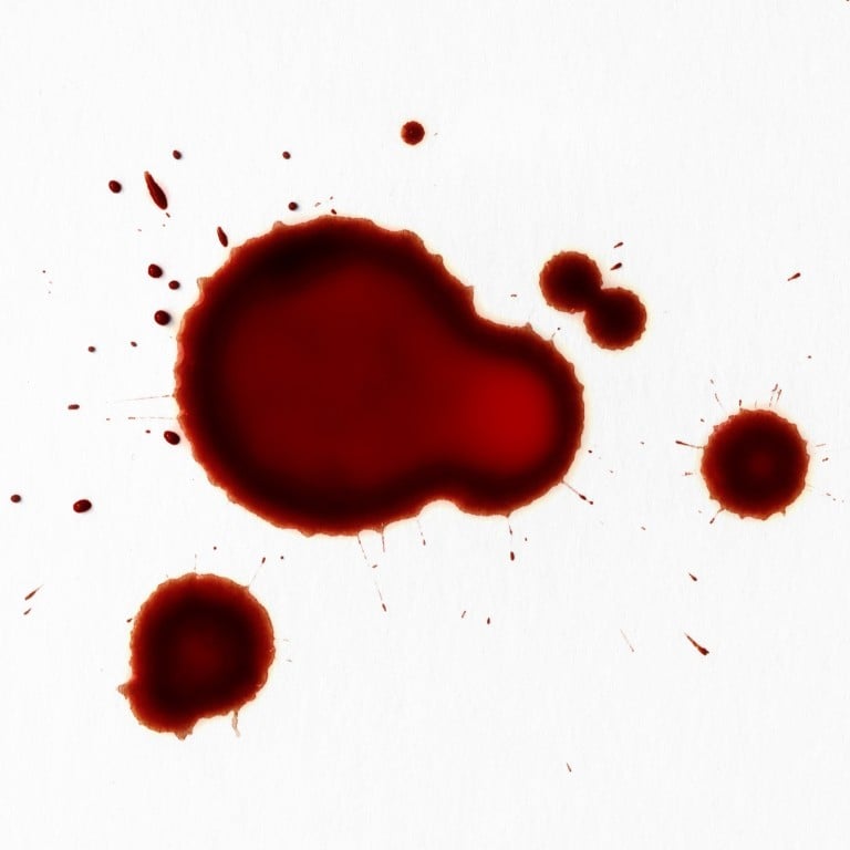 Why the science behind Kim Kardashian’s “vampire facial” remains popular – from platelet-rich plasma therapy to extracting stem cells after liposuction to be used in regenerative treatments. Photo: Getty Images