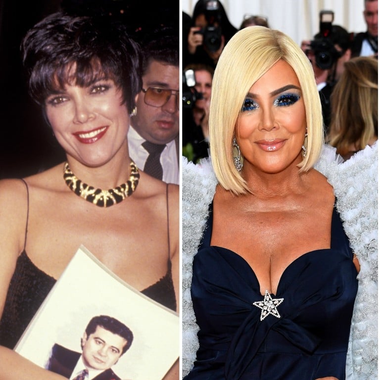 Kris Jenner through the years; the Kardashian-Jenner matriarch got a second facelift this year. Photos: Getty Images, @krisjenner/Instagram