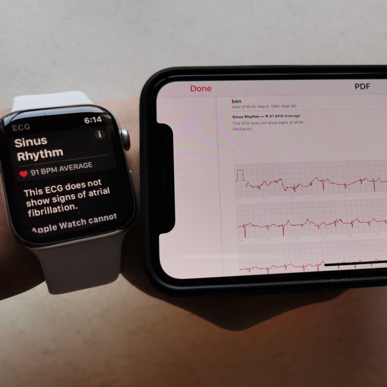 Iphone Apple Watch App 6 bd7f16ec 507a 11e9 8617 6babbcfb60eb image hires 151126