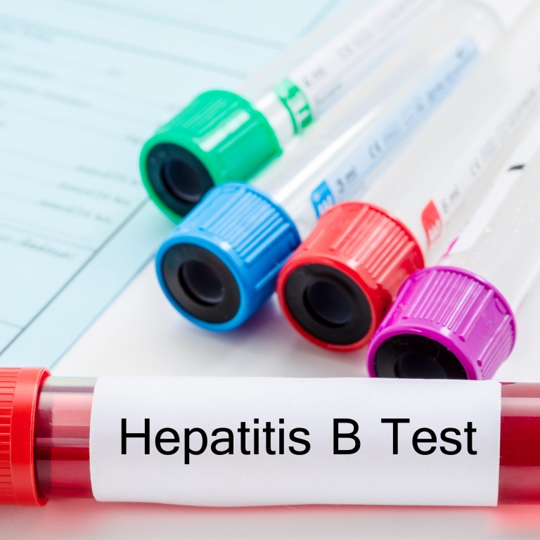 Hepatitis B Cure Research Health Organisations Patient Groups Scientists Launch Campaign South China Morning Post Hepatitis B Cure Research Health Organisations Patient Groups Scientists Launch Campaign South China Morning Post