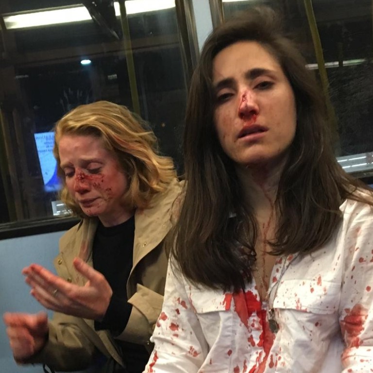 Four Teenagers Charged Over Homophobic Attack On Two Women On