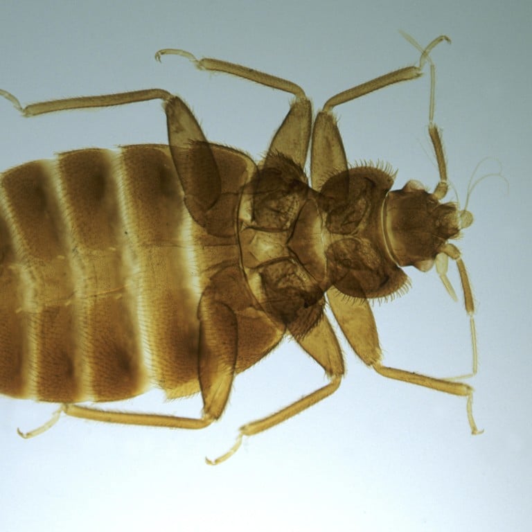 Как выглядит клоп под микроскопом Как выглядит клоп под микроскопом