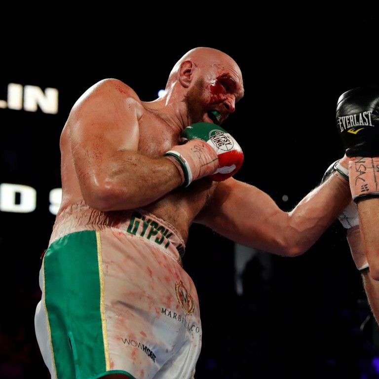 Ufc Dana White Says Tyson Fury Really Is Interested In Fighting In Mma South China Morning Post