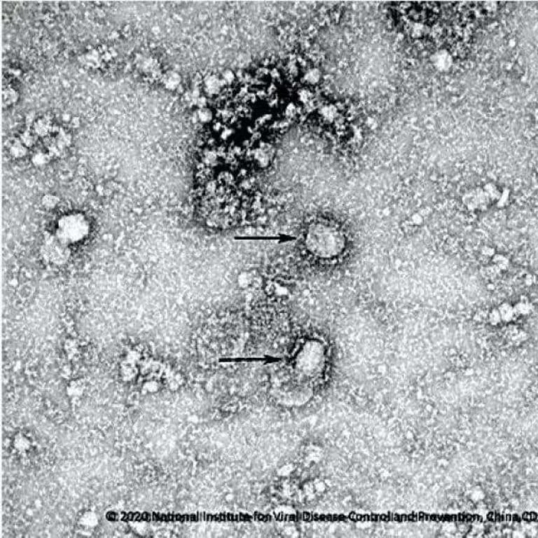 Image result for coronavirus china