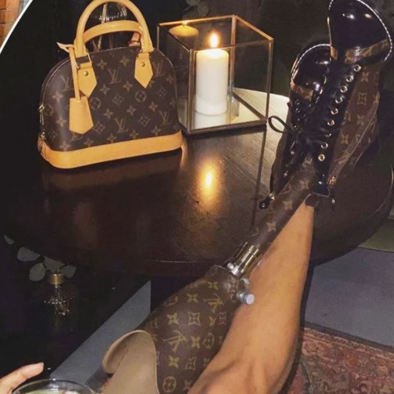 Model who lost her leg has a prosthetic limb made out of a vintage Louis  Vuitton bag