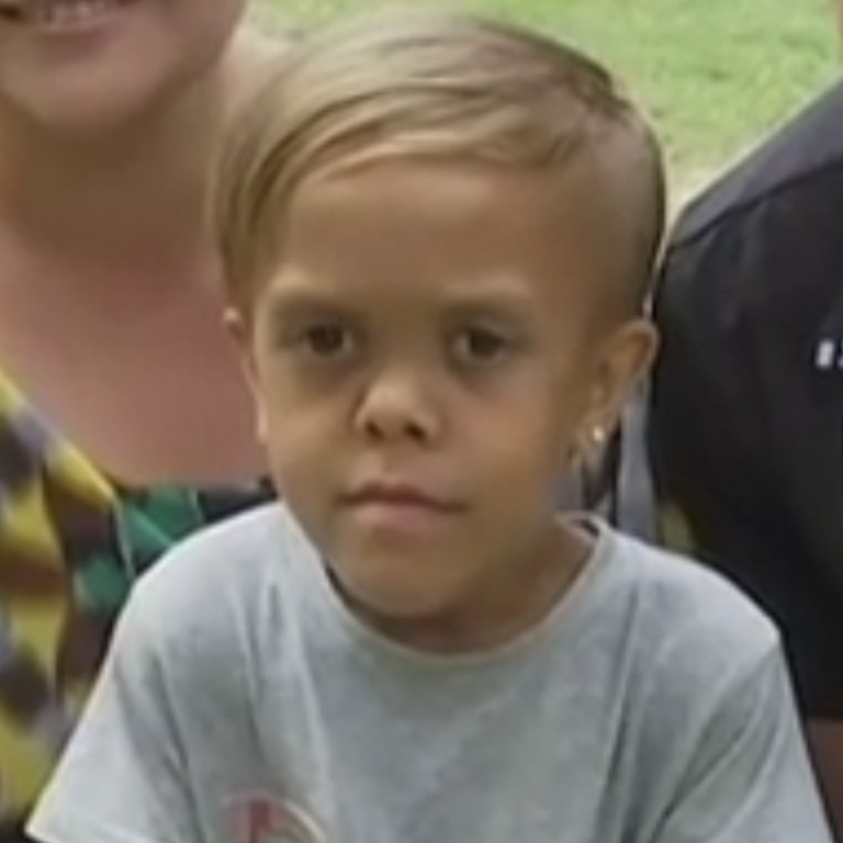 Celebrities Add Support To Fundraiser For Bullied Australian Boy