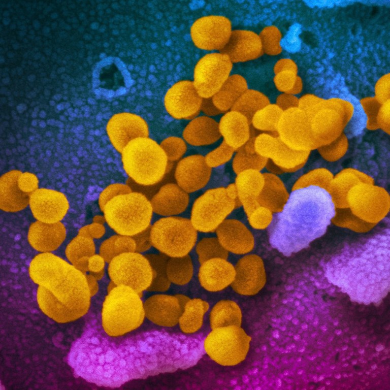 Coronavirus What Do Scientists Know About Covid 19 So Far World News The Guardian