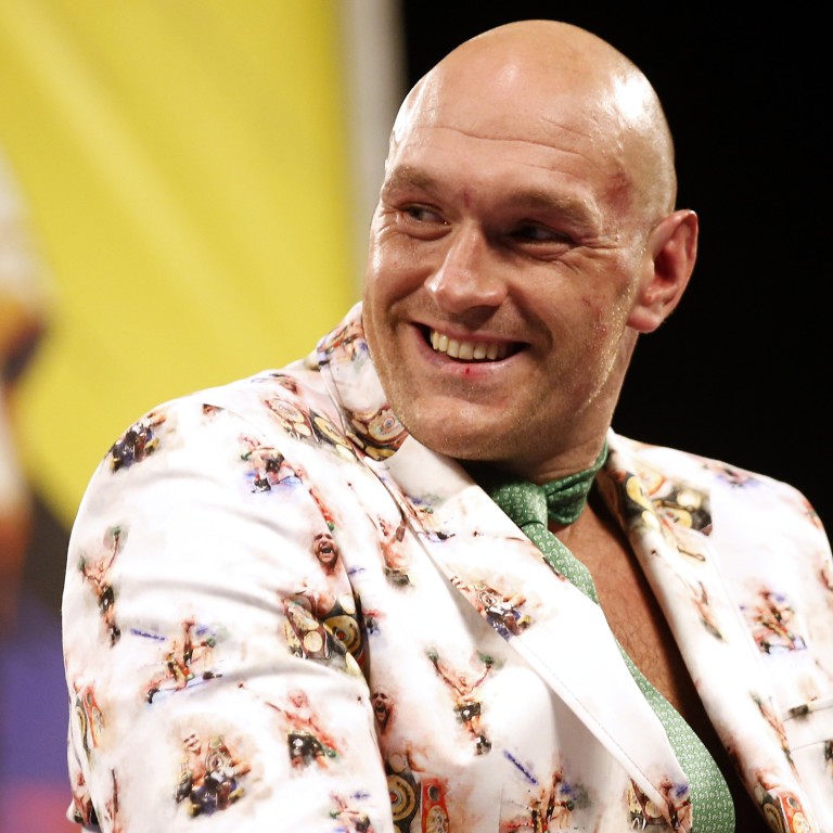 British boxer Tyson Fury is more than just muscle – as these five facts prove. Photo: PA Wire/DPA