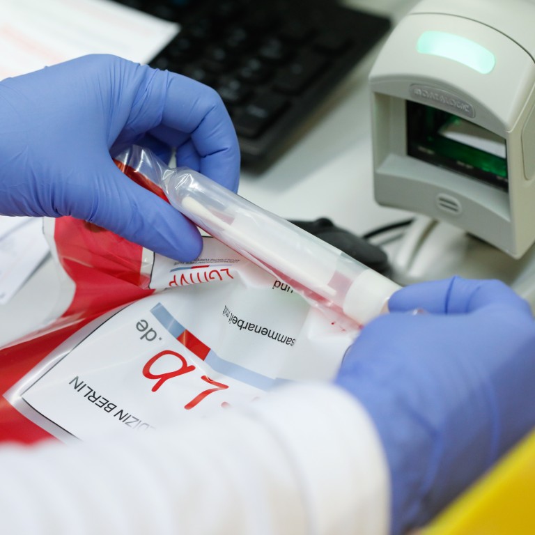 Coronavirus Why Rapid Result Test Kits Might Not Be The Quick Fix