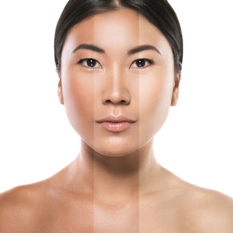 Skin Whitening The Prejudice Against Dark Skin And How Class In