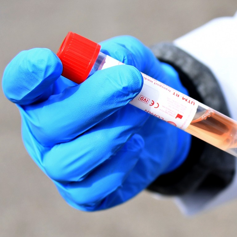 Coronavirus Us University Stops Using Chinese Testing Kits After Some Found To Be Contaminated South China Morning Post