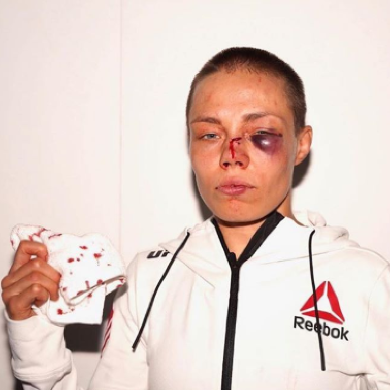 Ufc 251 Dana White Lauds Thug Rose Namajunas After Suffering