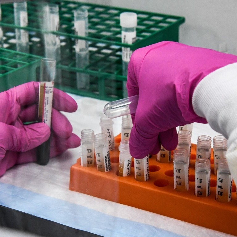 A lab technician sorts blood samples inside a lab for a Covid-19 vaccine study at the Research Centres of America (RCA) in Hollywood, Florida, in August. Photo: TNS