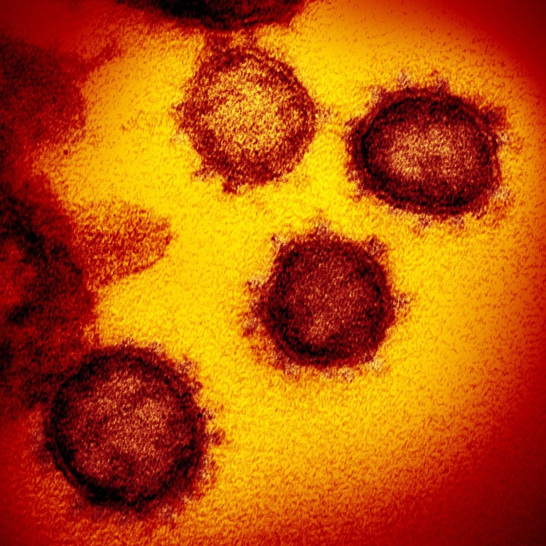 The WHO team will investigate if the pathogen possibly jumped from an animal to a human host in Wuhan. Photo: TNS