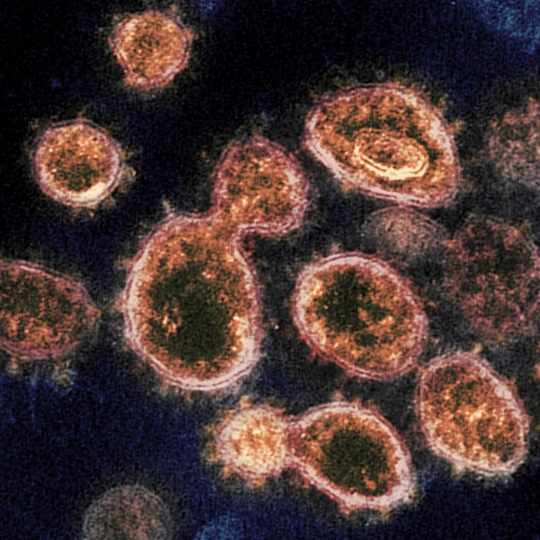 israel holds war game in case of lethal new coronavirus strain south china morning post
