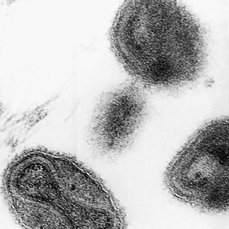 FBI and CDC investigate as vials labelled ‘Smallpox’ found in US lab ...