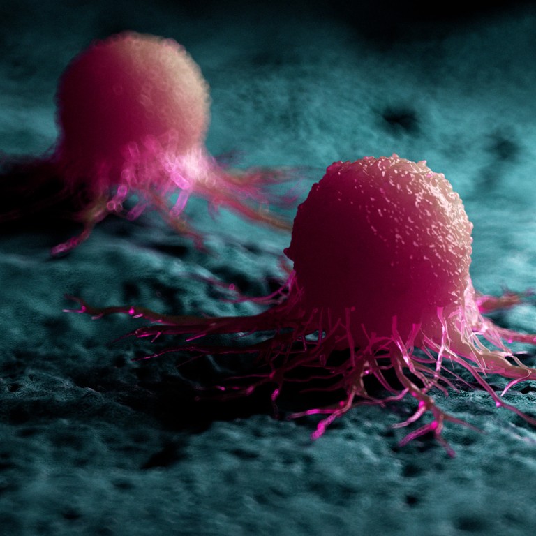 This compact Chinese device can detect cancer biomarkers in a drop of ...