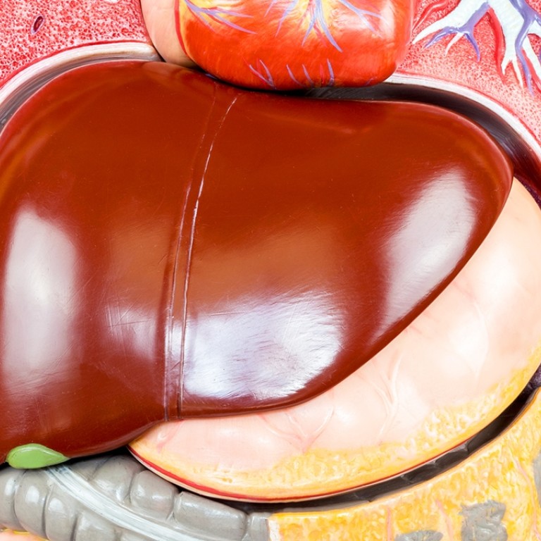 Be careful with those vitamin C pills antioxidants fuel cancer, warn