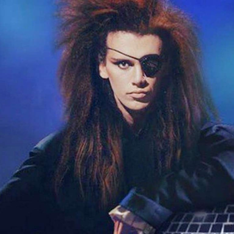 Pete Burns, the controversial singer of the band Dead Or Alive