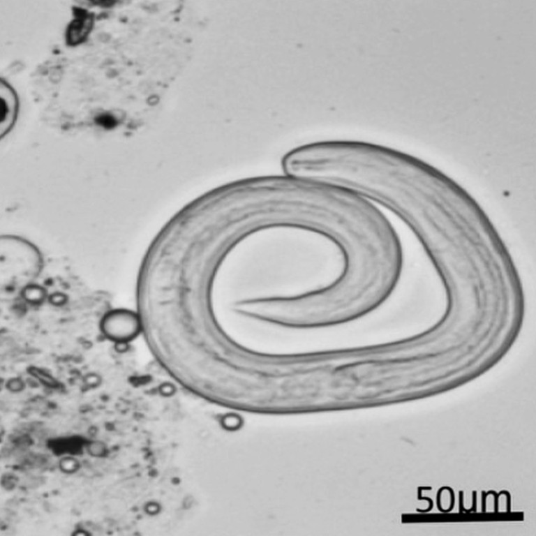 Lifethreatening parasite found in Chinese patients who ate raw