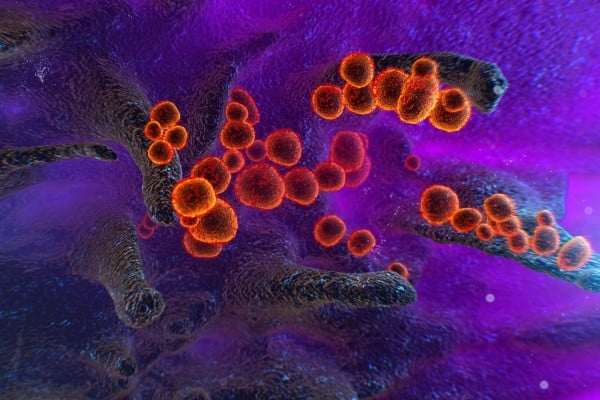 The virus that causes Covid-19 emerging from the surface of cells. Photo: Shutterstock