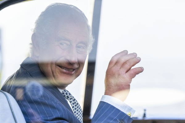 King Charles’ fingers have drawn attention recently for their puffiness and redness. It turns out our hands say a lot about our health. Photo: AFP