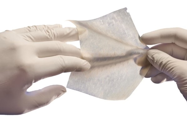 Cytal Burn Matrix is an evolution of artificial skin that is used to promote skin growth. Artificial skin’s uses have gone beyond treating burn victims to include helping fight skin cancer. Photo: Integra