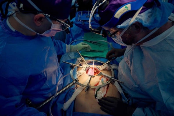 A team of surgeons transplants a pig kidney into a brain-dead human patient in New York in July. Photo: NYU Langone Health via AFP