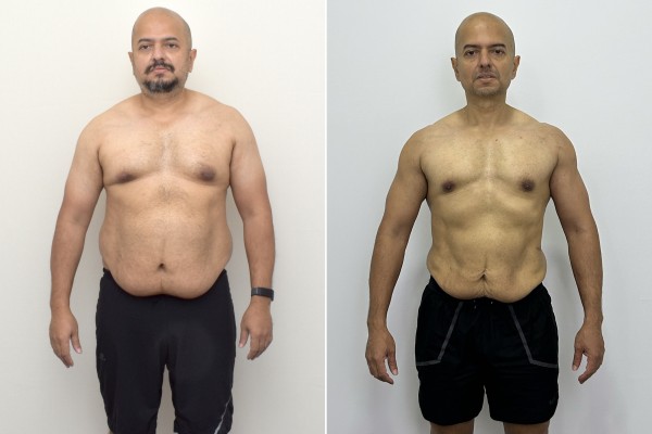 Avinash Gowda before he began losing weight a second time in January 2022 (above, left) and eight months later. Photo: Avinash Gowda Avinash Gowda before he began losing weight a second time in January 2022 (above, left) and eight months later. Photo: Avinash Gowda