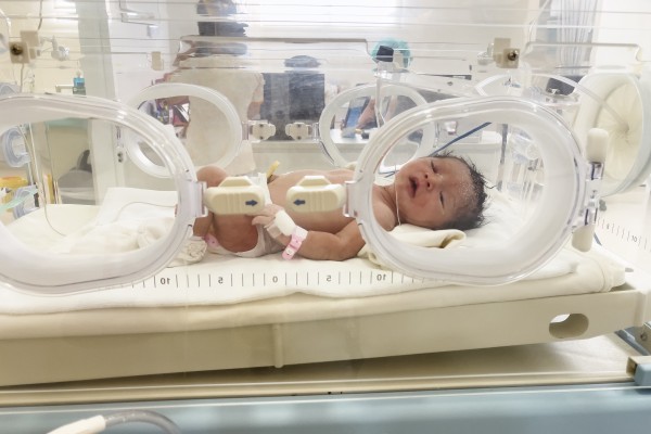 After surgery, babies born with congenital heart defects typically need a pacemaker for about a week while their hearts heal from surgery. Photo: Shutterstock