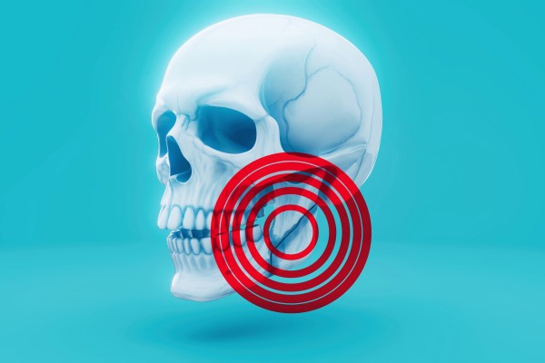 The rising number of cranio-maxillofacial injuries has prompted changes to military medical treatment protocols around the world. Photo: Shutterstock