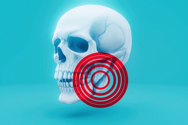 The rising number of cranio-maxillofacial injuries has prompted changes to military medical treatment protocols around the world. Photo: Shutterstock The rising number of cranio-maxillofacial injuries has prompted changes to military medical treatment protocols around the world. Photo: Shutterstock