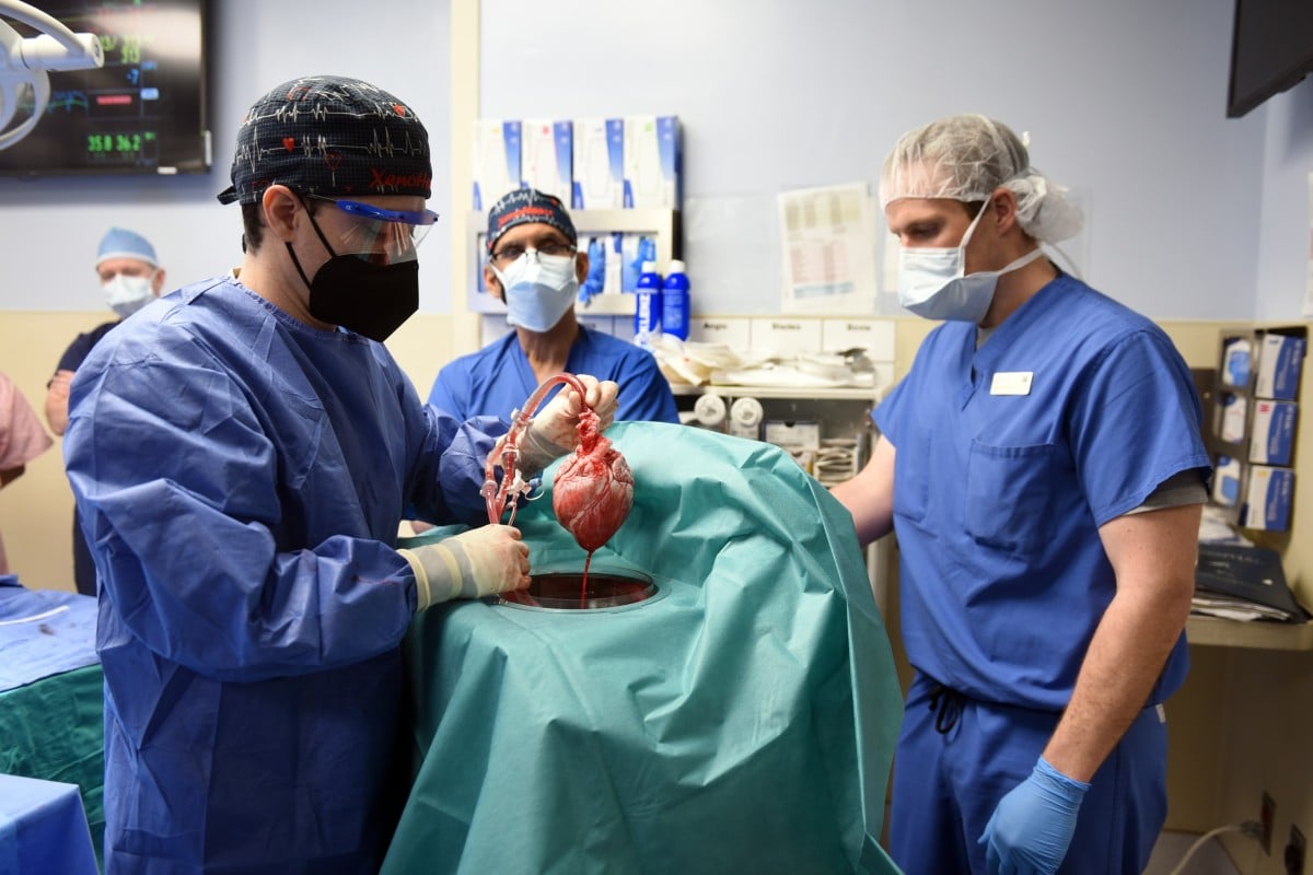 Surgeons implant the heart of a genetically modified pig into a human as part of a life-saving operation. Photo: EPA-EFE